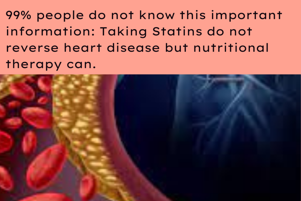 99% people do not know this important information Taking Statins do not reverse heart disease but nutritional therapy can.