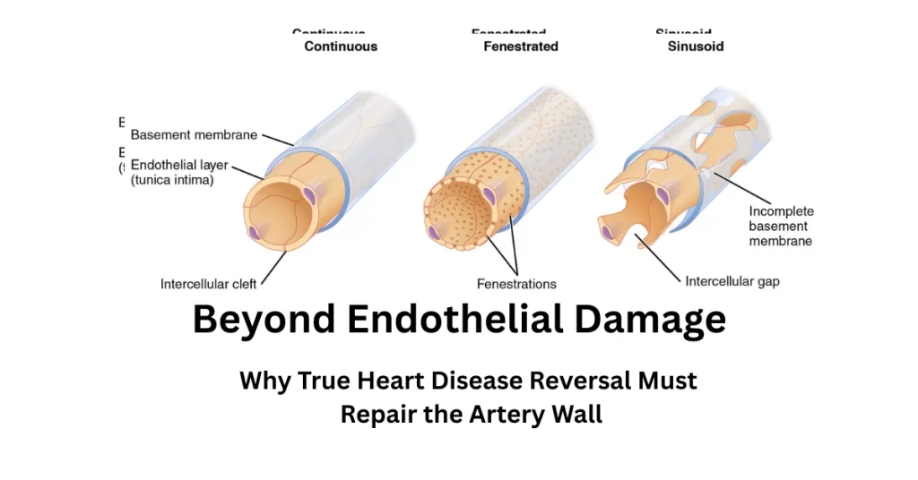 Beyond Endothelial Damage: Why True Heart Disease Reversal Must Repair the Artery Wall