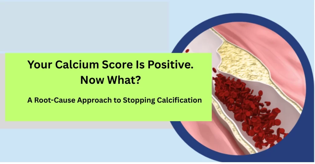 - Your Calcium Score Is Positive. Now What? A Root-Cause Approach to Stopping Calcification